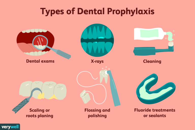 dental prophylaxis